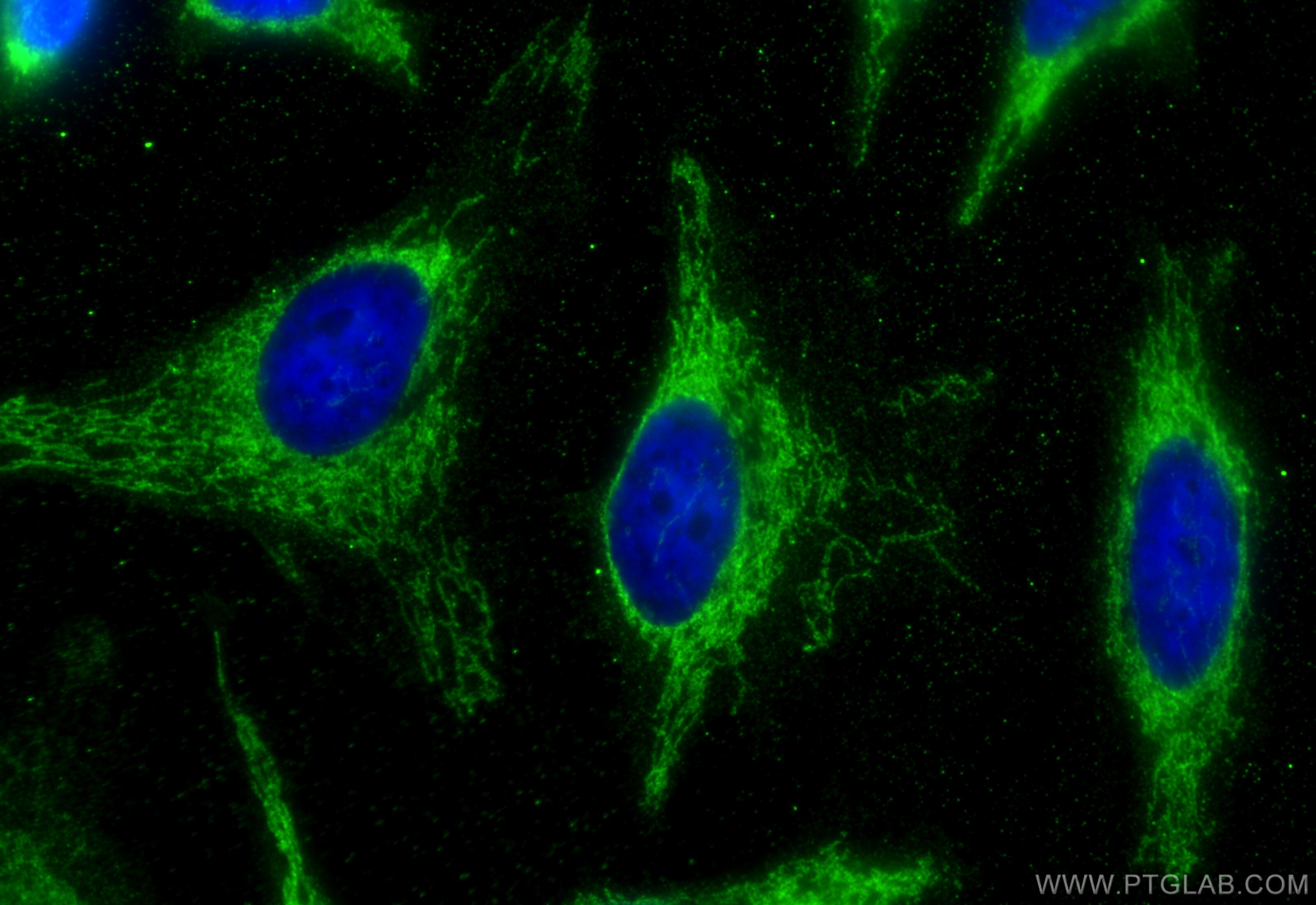 Immunofluorescence (IF) / fluorescent staining of HeLa cells using PDH E1 Alpha Monoclonal antibody (66119-1-Ig)