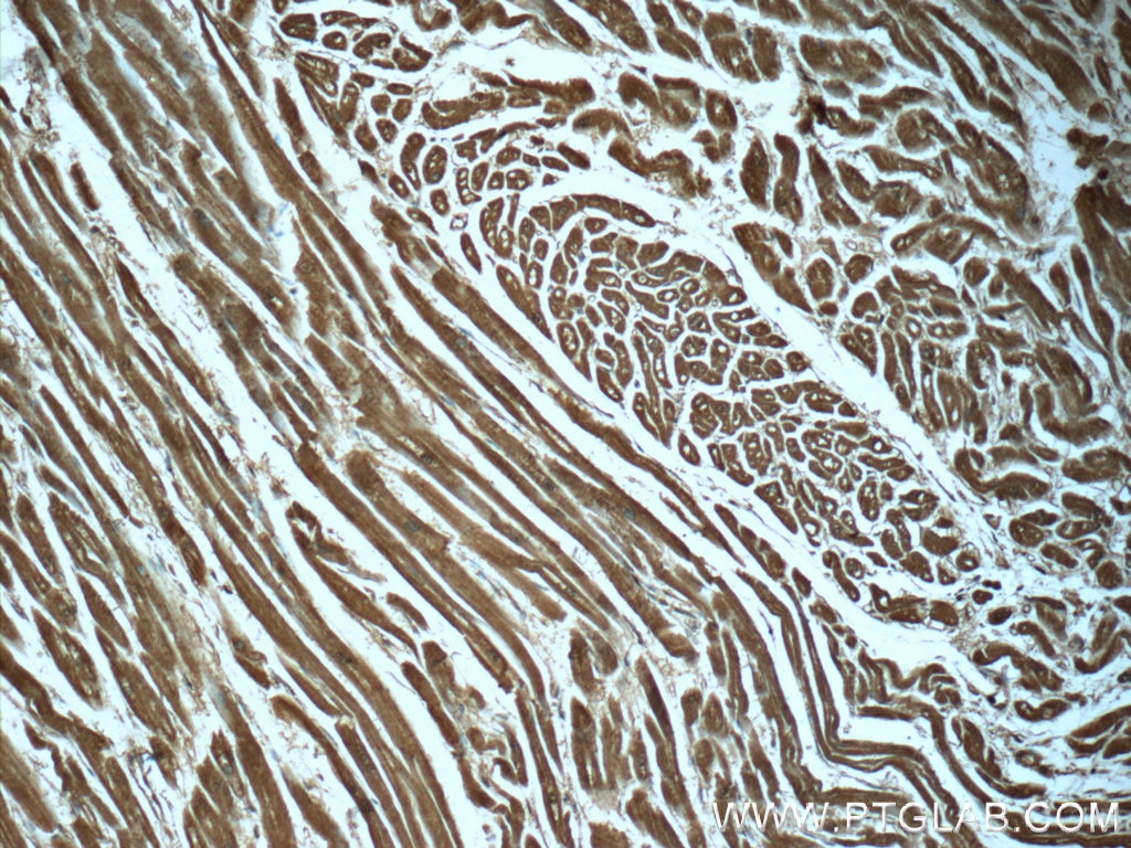 Immunohistochemistry (IHC) staining of human heart tissue using PDH E1 Alpha Monoclonal antibody (66119-1-Ig)