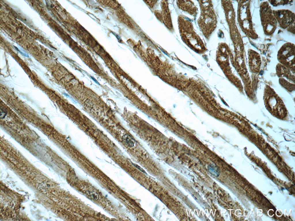 Immunohistochemistry (IHC) staining of human heart tissue using PDH E1 Alpha Monoclonal antibody (66119-1-Ig)