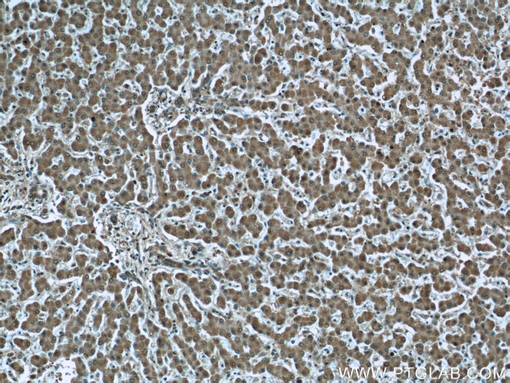 Immunohistochemistry (IHC) staining of human liver tissue using PDH E1 Alpha Monoclonal antibody (66119-1-Ig)