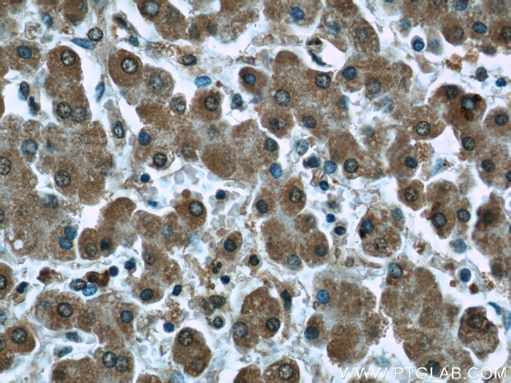 Immunohistochemistry (IHC) staining of human liver tissue using PDH E1 Alpha Monoclonal antibody (66119-1-Ig)