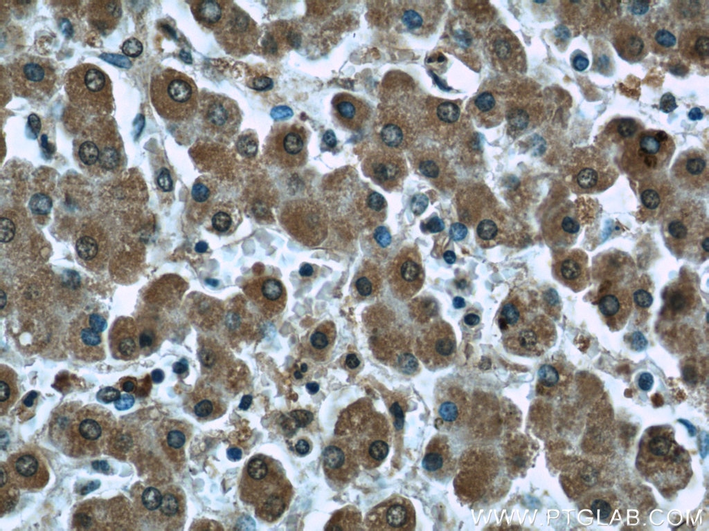 IHC staining of human liver using 66119-1-Ig