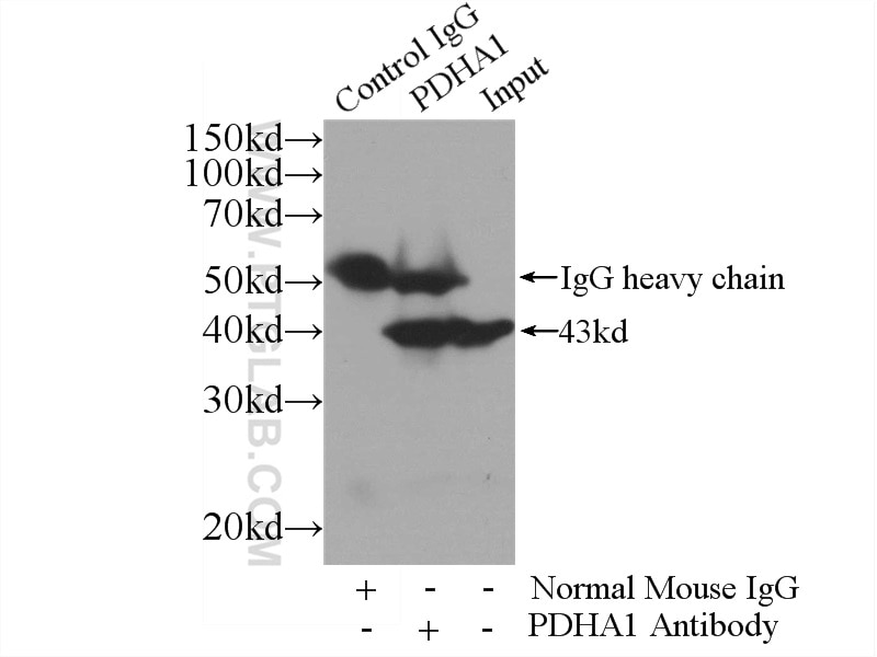 Immunoprecipitation (IP) experiment of HEK-293 cells using PDH E1 Alpha Monoclonal antibody (66119-1-Ig)