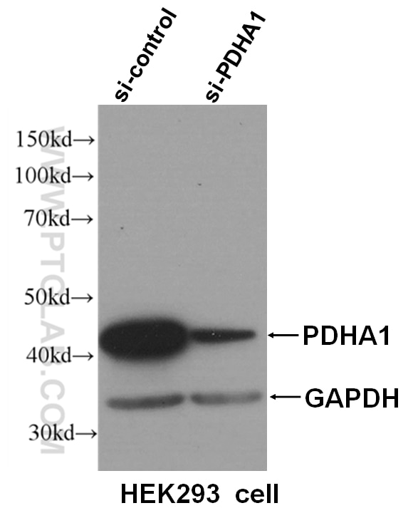 Western Blot (WB) analysis of HEK293 cells using PDH E1 Alpha Monoclonal antibody (66119-1-Ig)