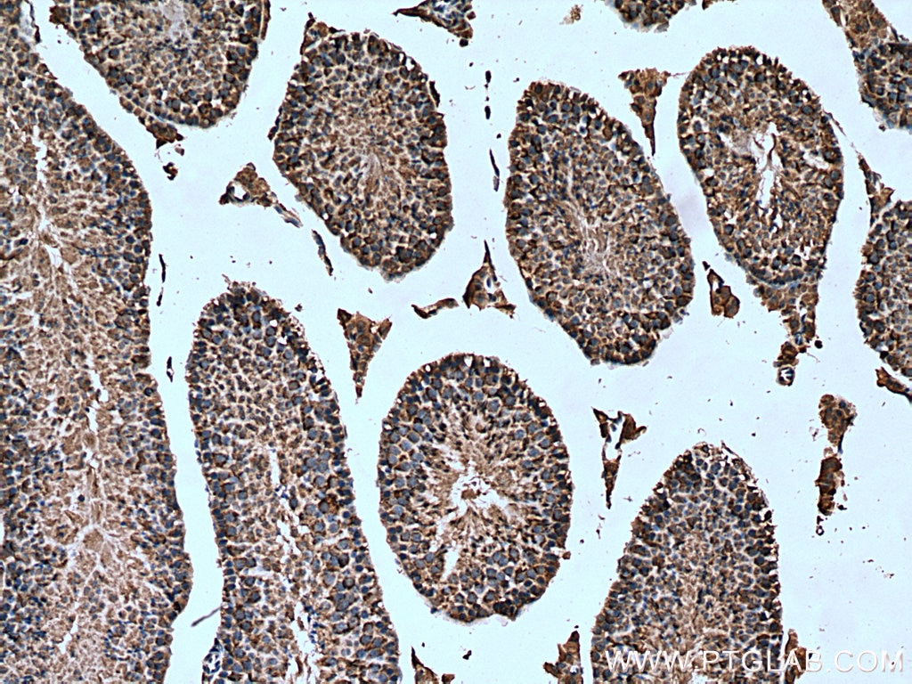 Immunohistochemistry (IHC) staining of mouse testis tissue using PDHA2 Polyclonal antibody (17134-1-AP)