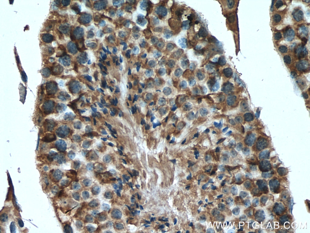 Immunohistochemistry (IHC) staining of mouse testis tissue using PDHA2 Polyclonal antibody (17134-1-AP)