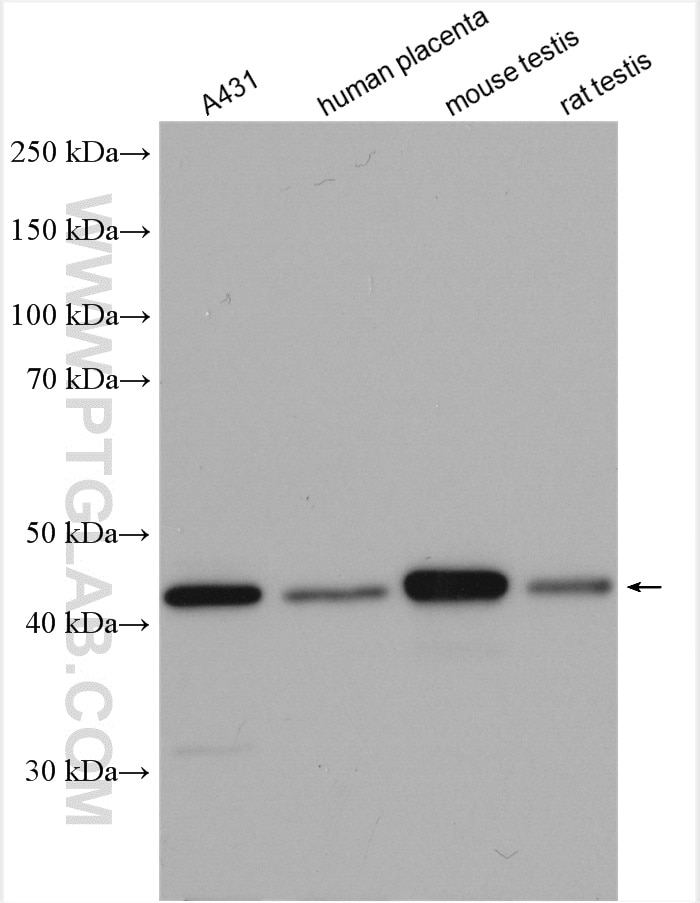 Western Blot (WB) analysis of various lysates using PDHA2 Polyclonal antibody (17134-1-AP)