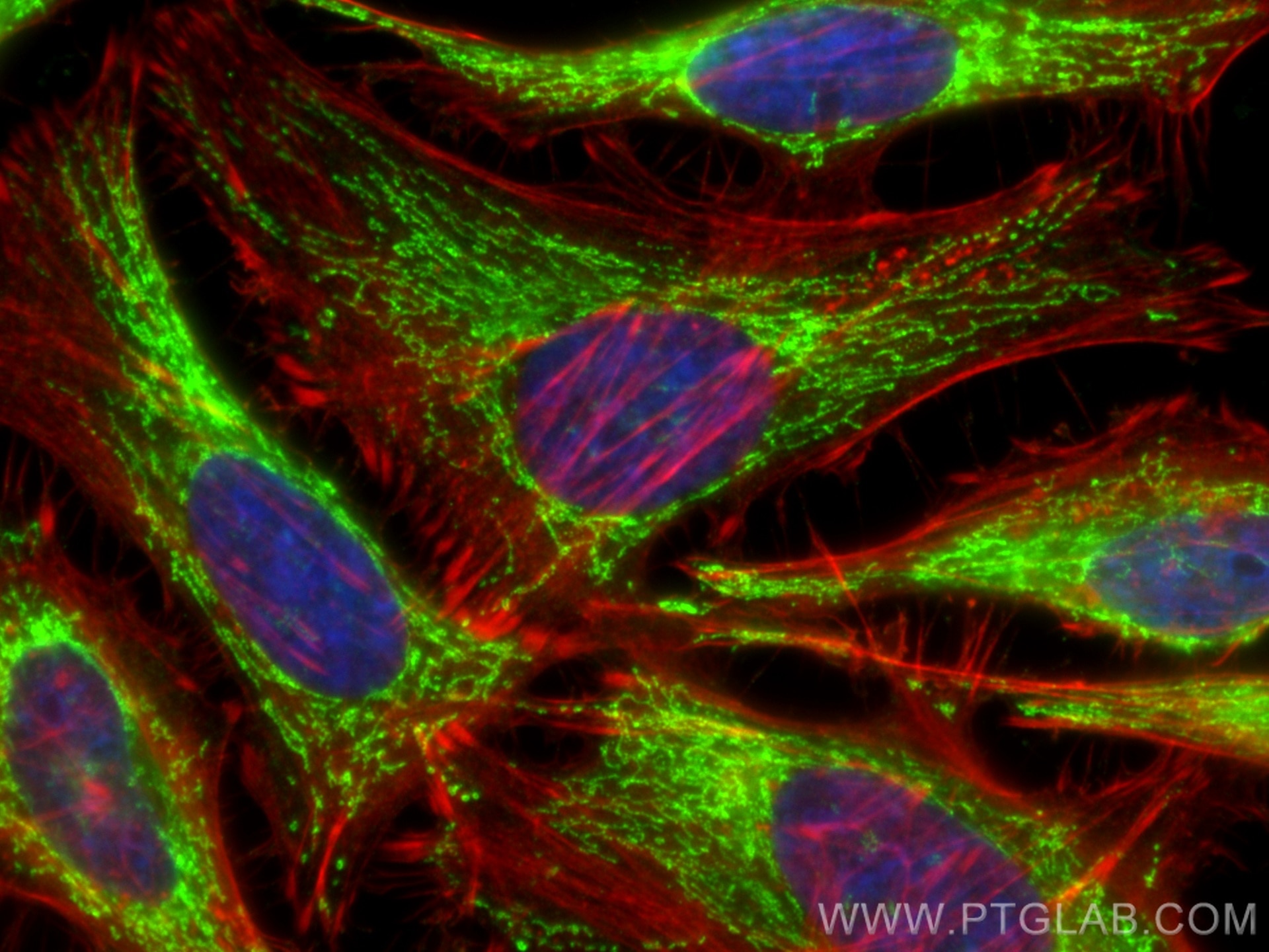 Immunofluorescence (IF) / fluorescent staining of HeLa cells using PDHB Polyclonal antibody (14744-1-AP)