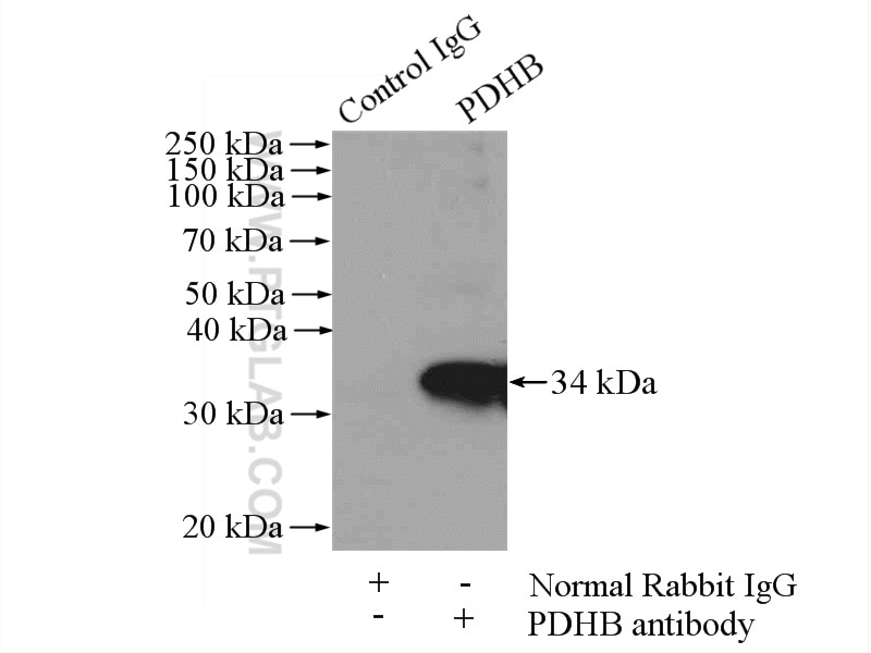 Immunoprecipitation (IP) experiment of mouse heart tissue using PDHB Polyclonal antibody (14744-1-AP)