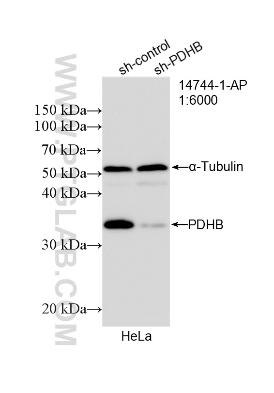 WB result of PDHB antibody (14744-1-AP; 1:6000; incubated at room temperature for 1.5 hours) with sh-Control and sh-PDHB transfected HeLa cells. Western Blot (WB) analysis of HeLa cells using PDHB Polyclonal antibody (14744-1-AP)