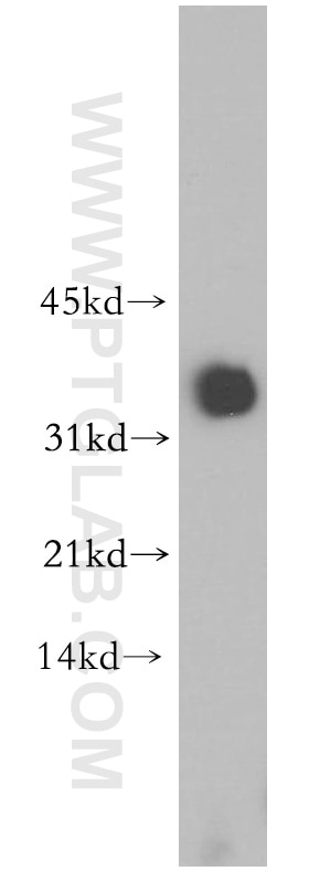 Western Blot (WB) analysis of human heart tissue using PDHB Polyclonal antibody (14744-1-AP)