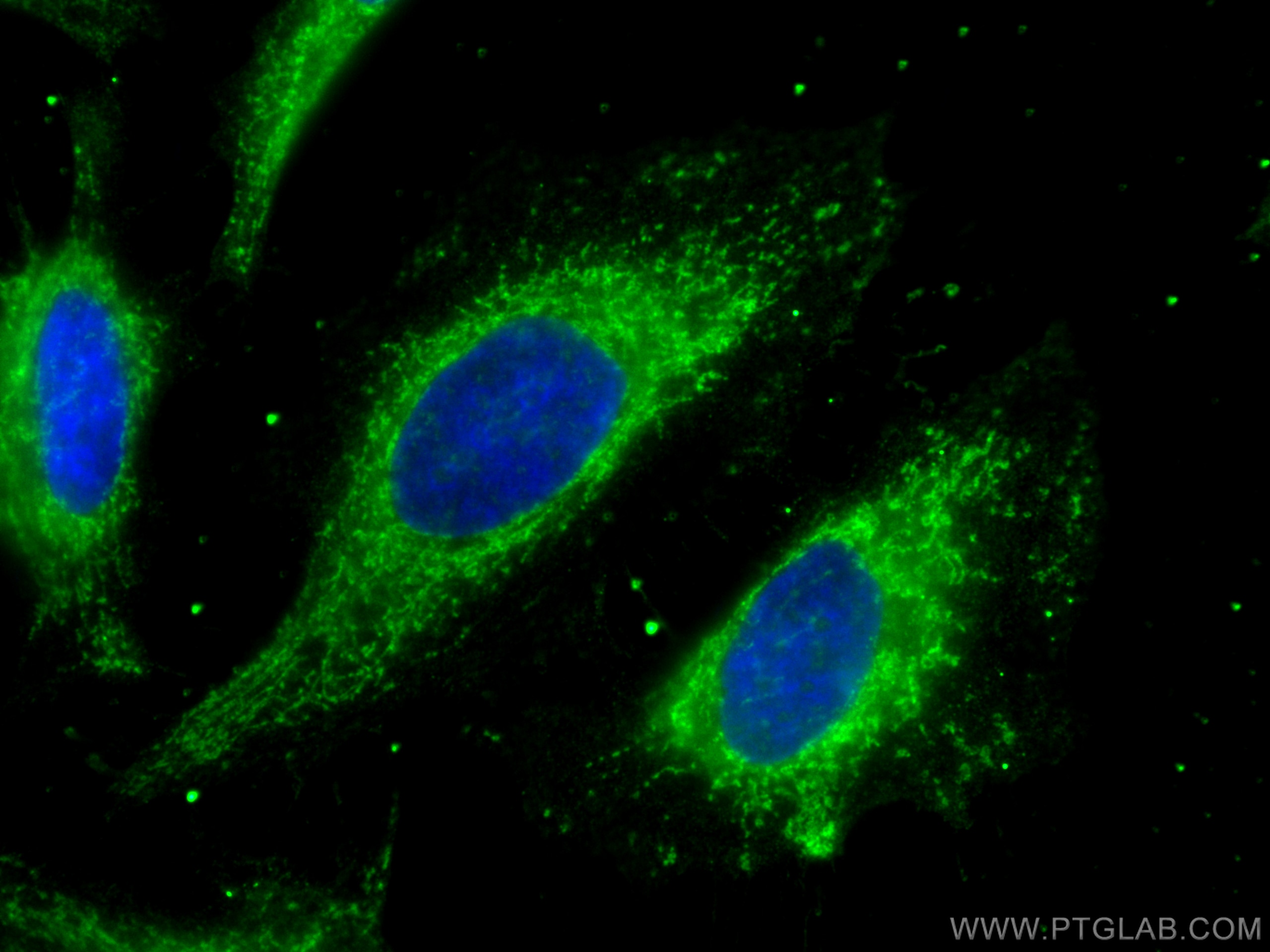 Immunofluorescence (IF) / fluorescent staining of HeLa cells using PDHB Monoclonal antibody (68238-1-Ig)