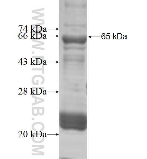 PDHB fusion protein Ag6442 SDS-PAGE
