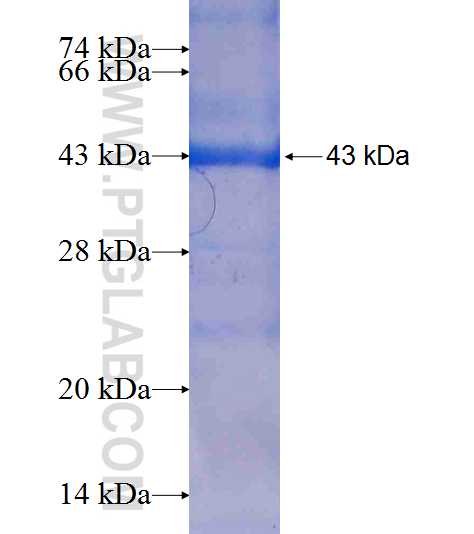 PDHB fusion protein Ag6857 SDS-PAGE