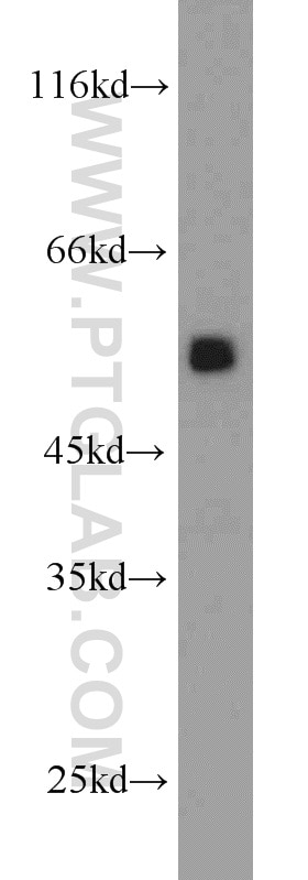 Western Blot (WB) analysis of HEK-293 cells using PDHX Polyclonal antibody (10951-1-AP)