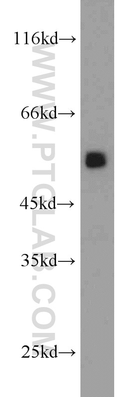 WB analysis of HEK-293 using 10951-1-AP