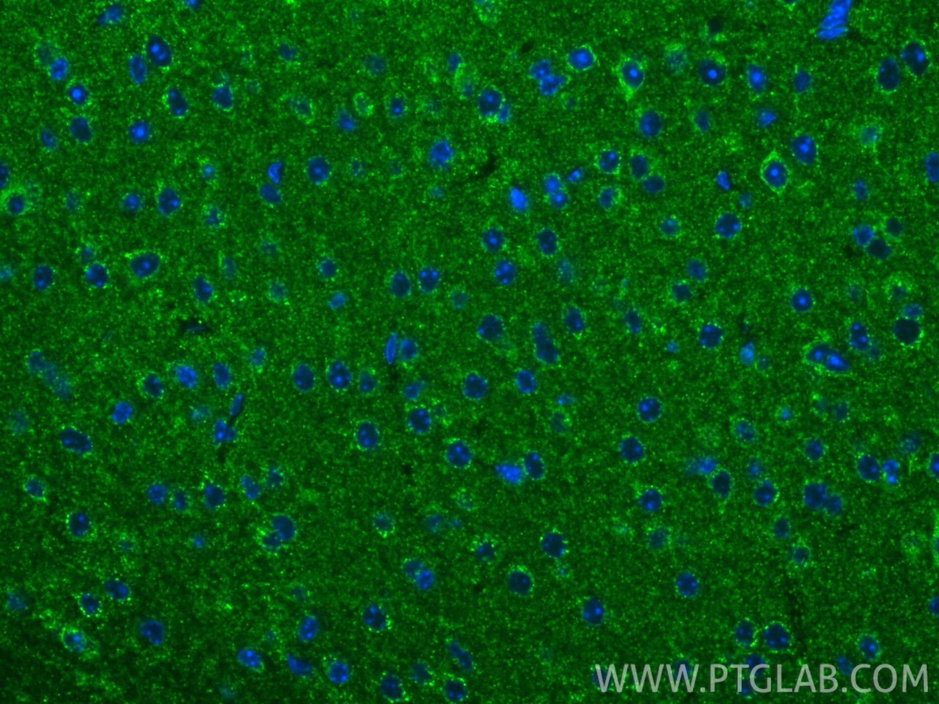 Immunofluorescence (IF) / fluorescent staining of mouse brain tissue using PDHX Recombinant monoclonal antibody (87880-1-RR)