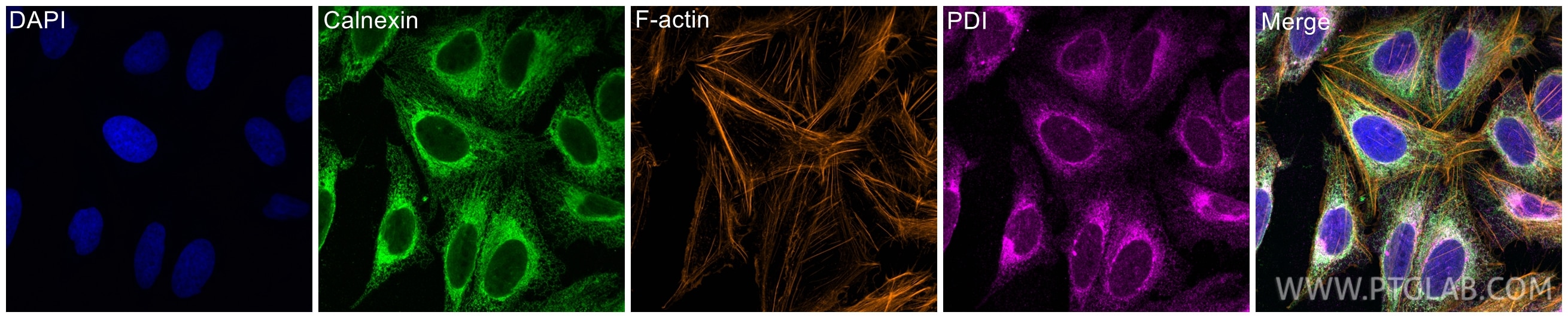 Immunofluorescence (IF) / fluorescent staining of U2OS cells using PDI Monoclonal antibody (66422-1-Ig)