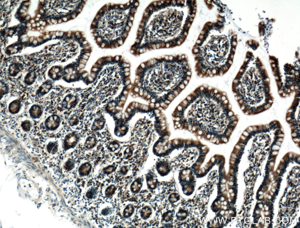 Immunohistochemistry (IHC) staining of human small intestine tissue using PDI Monoclonal antibody (66422-1-Ig)