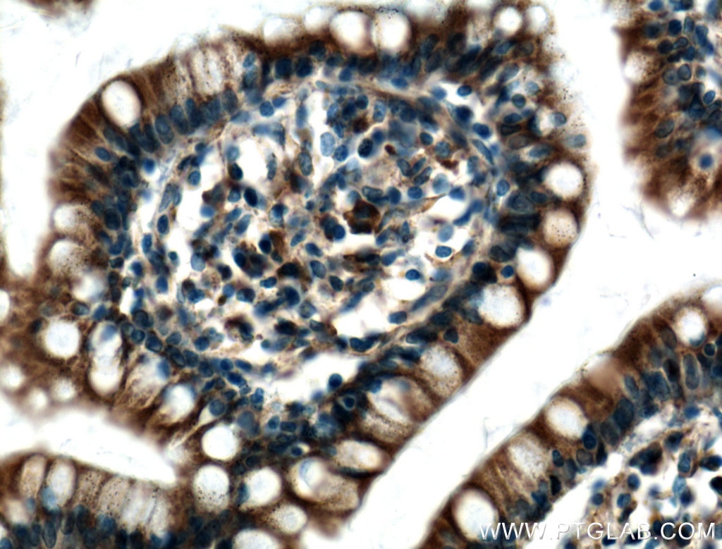 Immunohistochemistry (IHC) staining of human small intestine tissue using PDI Monoclonal antibody (66422-1-Ig)