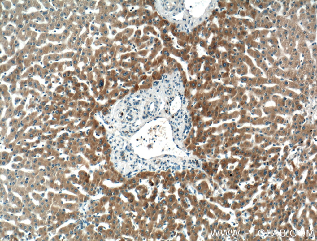 Immunohistochemistry (IHC) staining of human liver tissue using PDI Monoclonal antibody (66422-1-Ig)