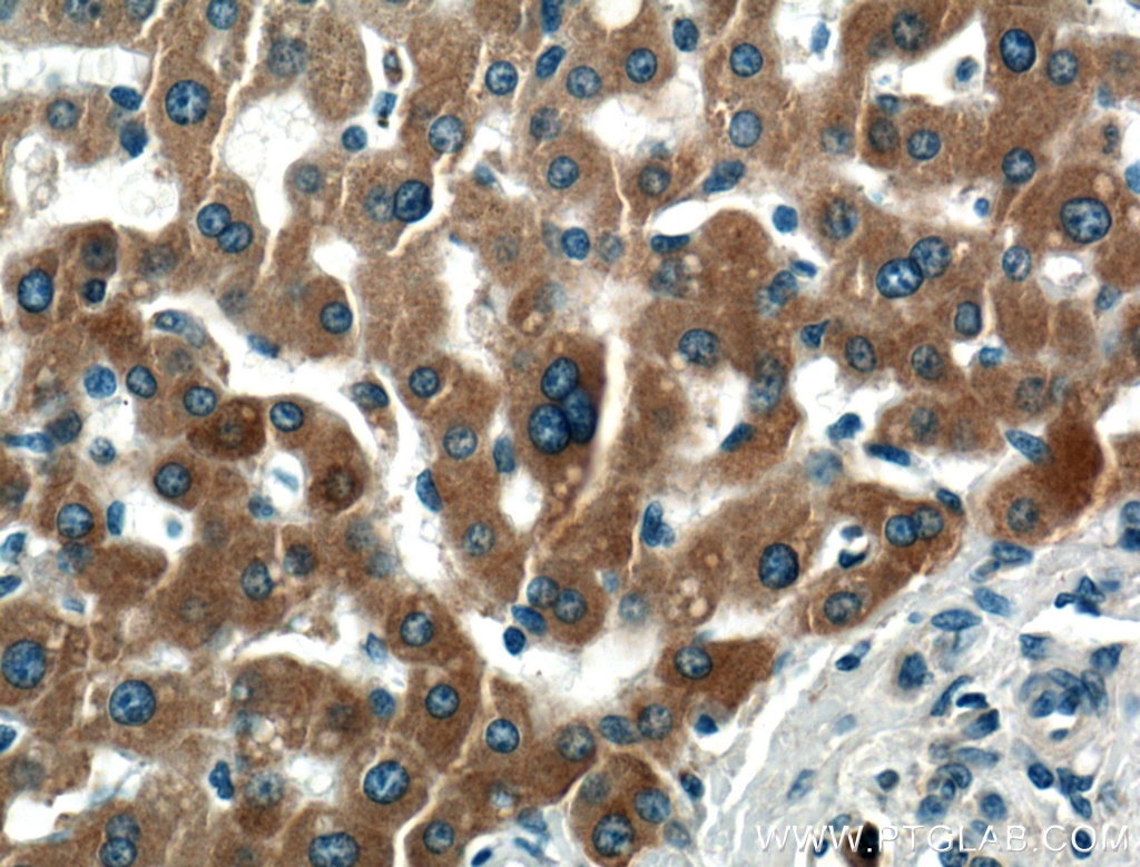 Immunohistochemistry (IHC) staining of human liver tissue using PDI Monoclonal antibody (66422-1-Ig)