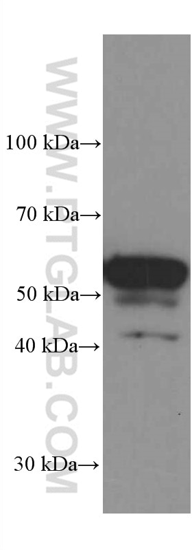 Western Blot (WB) analysis of rat brain tissue using PDI Monoclonal antibody (66422-1-Ig)