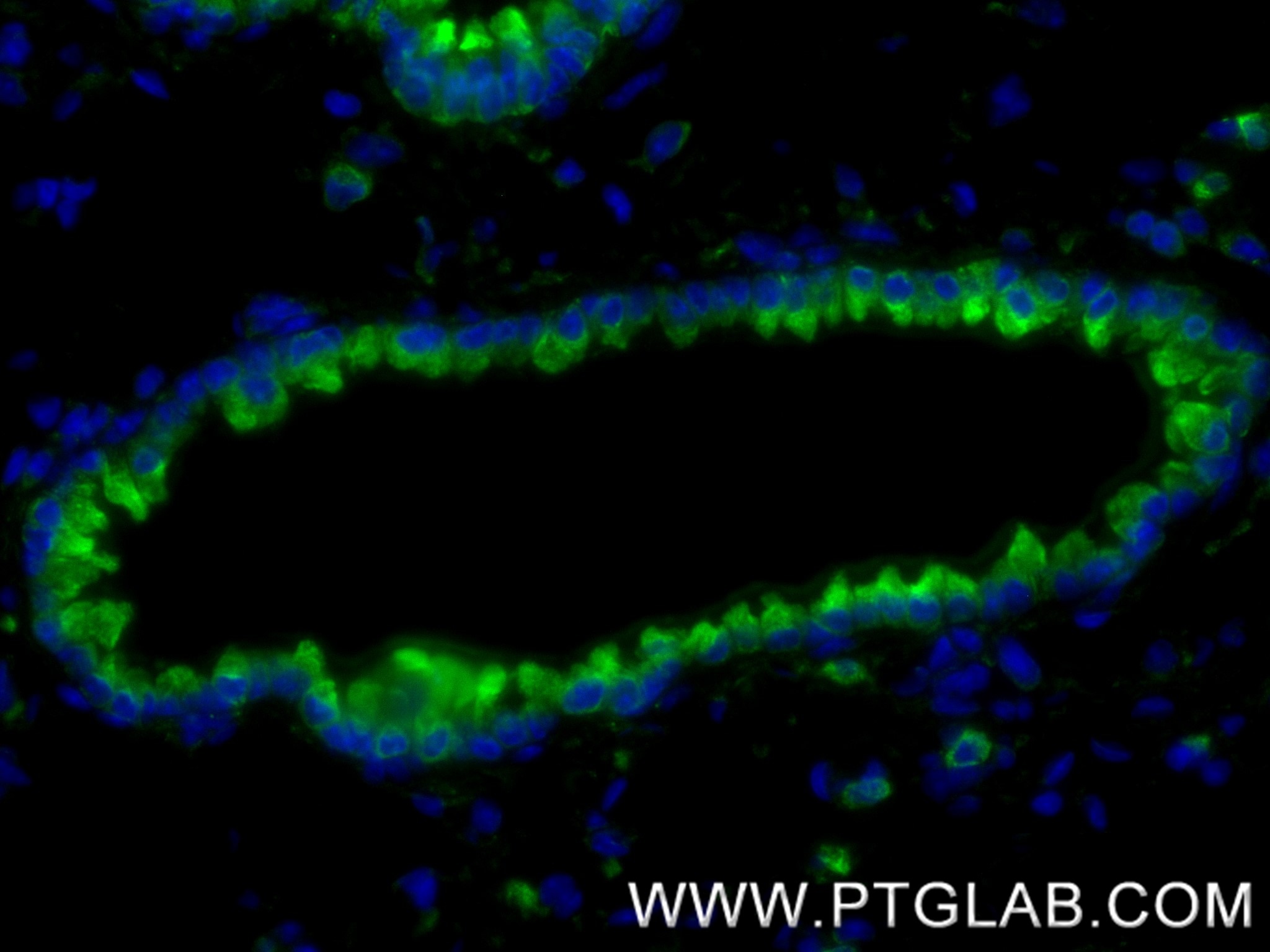 Immunofluorescence (IF) / fluorescent staining of mouse lung tissue using PDI Recombinant antibody (80170-1-RR)