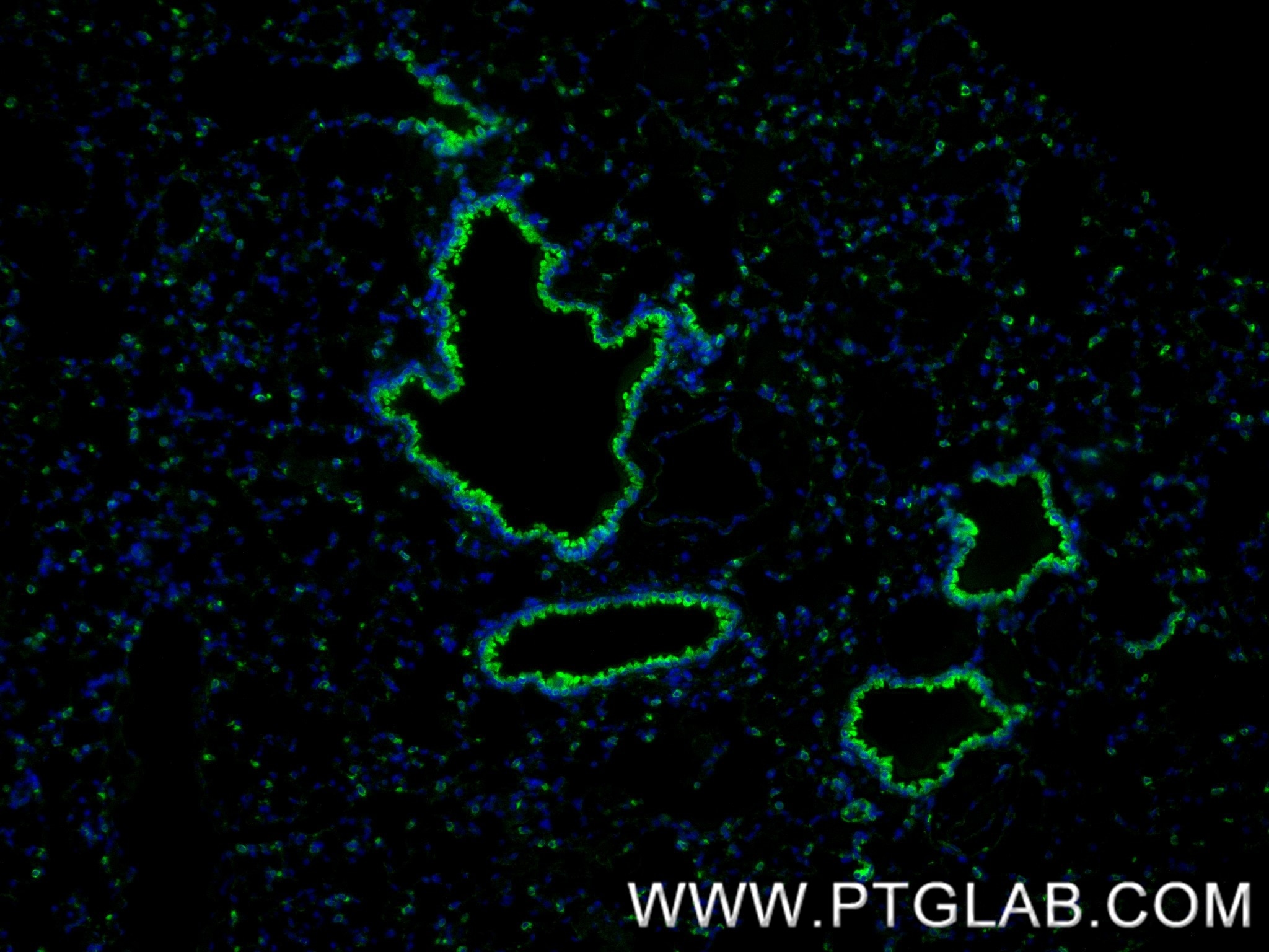 Immunofluorescence (IF) / fluorescent staining of mouse lung tissue using PDI Recombinant antibody (80170-1-RR)