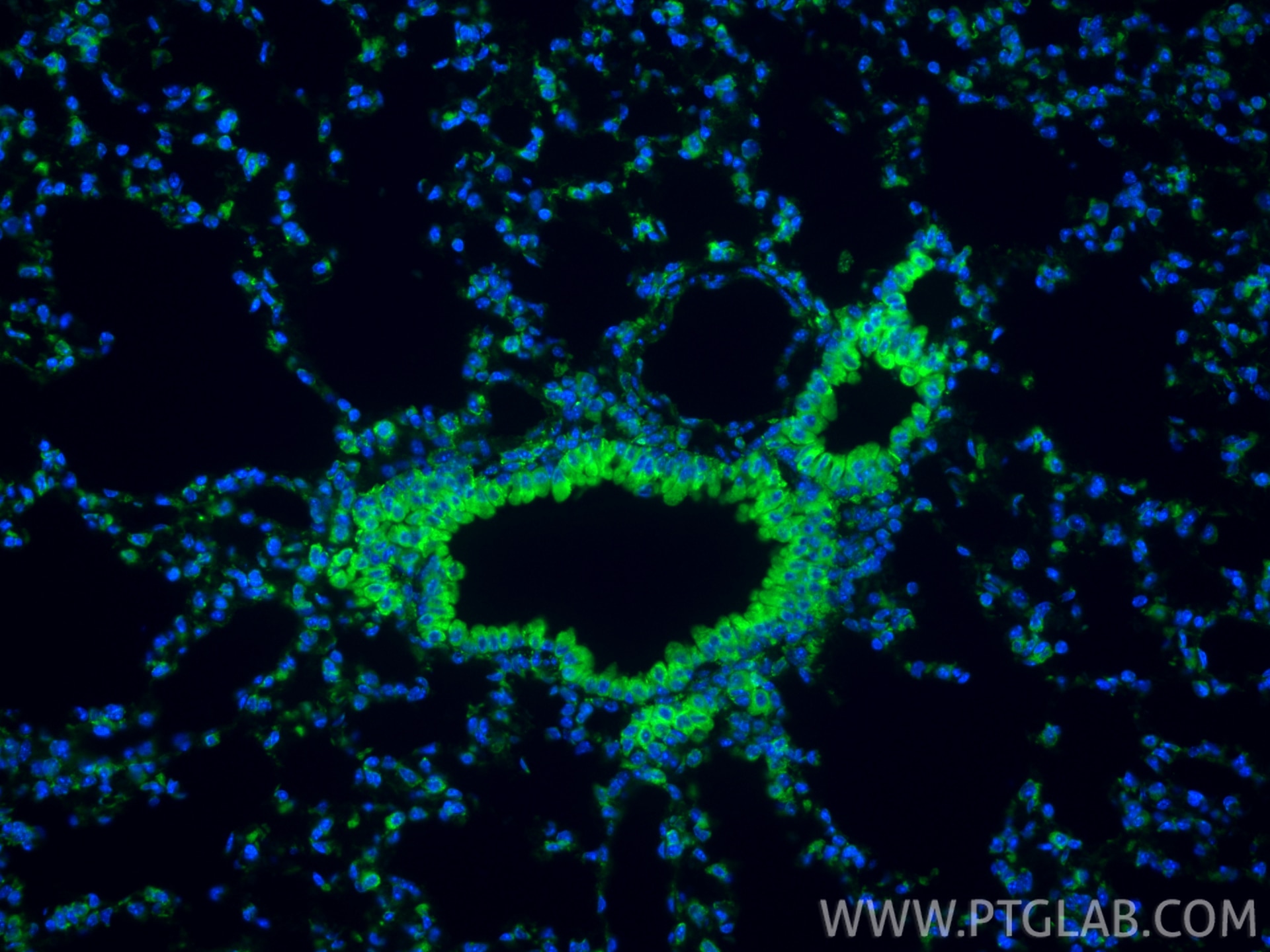 Immunofluorescent analysis of (4% PFA) fixed paraffin-embedded mouse lung tissue using CoraLite® Plus 488 PDI antibody (CL488-80170, Clone: 4K17 ) at dilution of 1:200. Heat mediated antigen retrieval with Tris-EDTA buffer (pH 9.0). Immunofluorescence (IF) / fluorescent staining of mouse lung tissue using CoraLite® Plus 488-conjugated PDI Recombinant mono (CL488-80170)