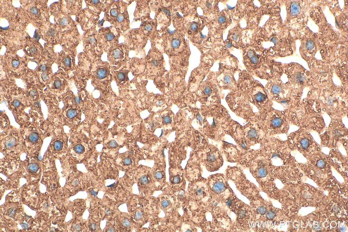 Immunohistochemical analysis of paraffin-embedded mouse liver tissue slide using 11245-1-AP (PDI antibody) at dilution of 1:200 (under 40x lens). Heat mediated antigen retrieval with Tris-EDTA buffer (pH 9.0). Immunohistochemistry (IHC) staining of mouse liver tissue using PDI Polyclonal antibody (11245-1-AP)
