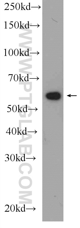 Western Blot (WB) analysis of rat heart tissue using PDI Polyclonal antibody (11245-1-AP)