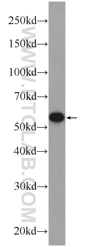 Western Blot (WB) analysis of mouse thymus tissue using PDI Polyclonal antibody (11245-1-AP)