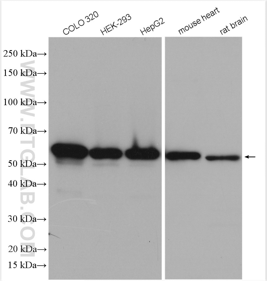 Western Blot (WB) analysis of various lysates using PDI Polyclonal antibody (11245-1-AP)