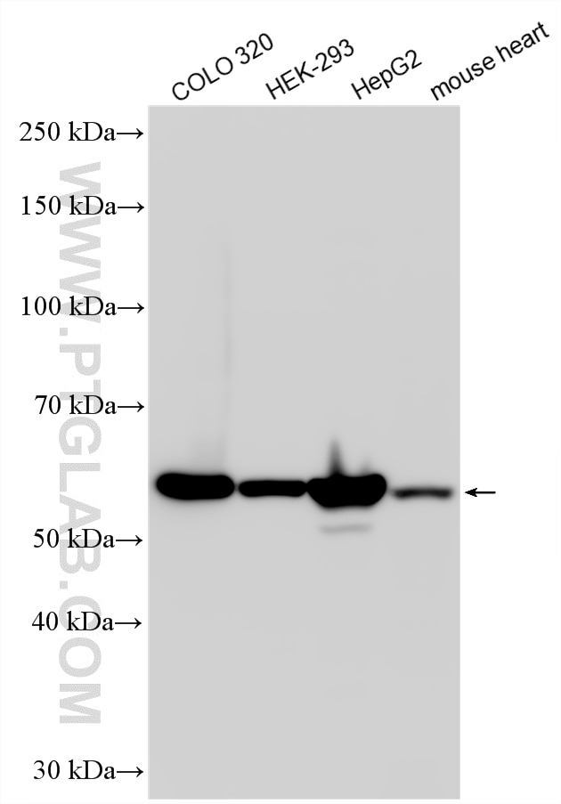Western Blot (WB) analysis of various lysates using PDI Polyclonal antibody (11245-1-AP)