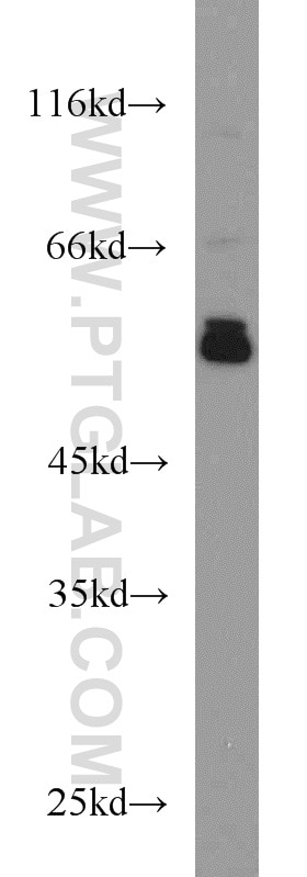 ERp57/ERp60 Polyclonal antibody