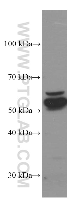 Western Blot (WB) analysis of HeLa cells using ERp57/ERp60 Monoclonal antibody (66423-1-Ig)