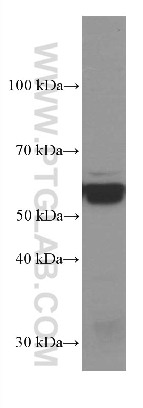 Western Blot (WB) analysis of HEK-293 cells using ERp57/ERp60 Monoclonal antibody (66423-1-Ig)