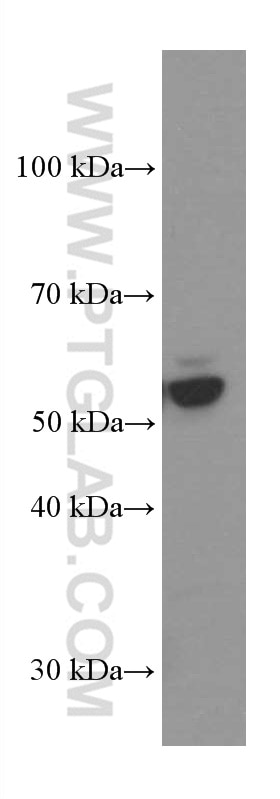 Western Blot (WB) analysis of Jurkat cells using ERp57/ERp60 Monoclonal antibody (66423-1-Ig)
