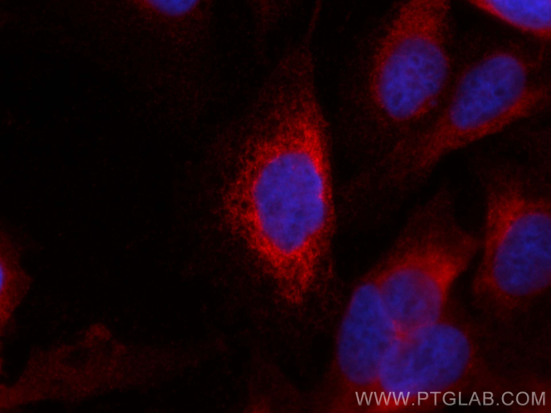 Immunofluorescence (IF) / fluorescent staining of U2OS cells using CoraLite®594-conjugated PDIA3 Monoclonal antibody (CL594-66423)