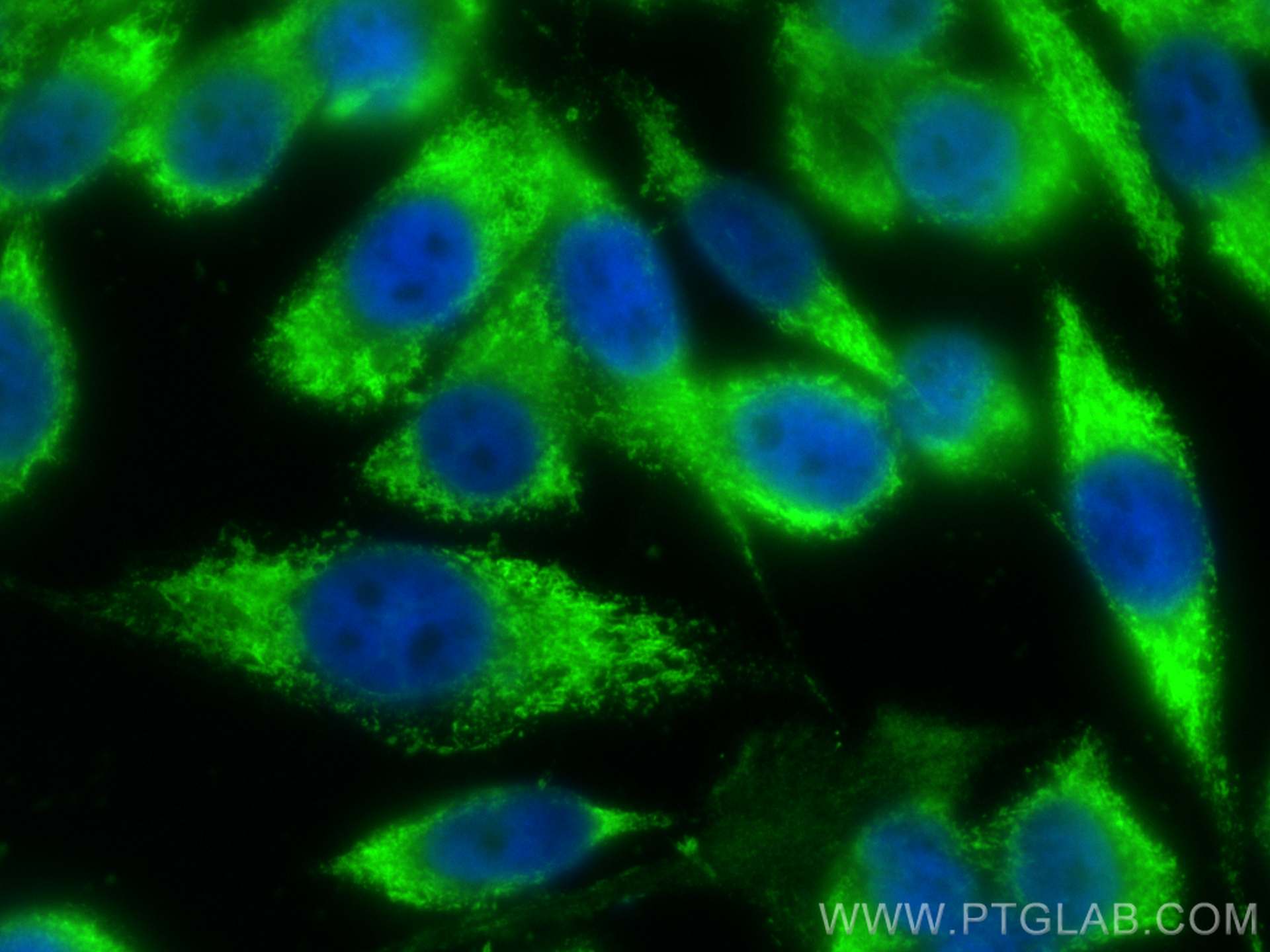 Immunofluorescence (IF) / fluorescent staining of PC-3 cells using ERp72 Polyclonal antibody (14712-1-AP)
