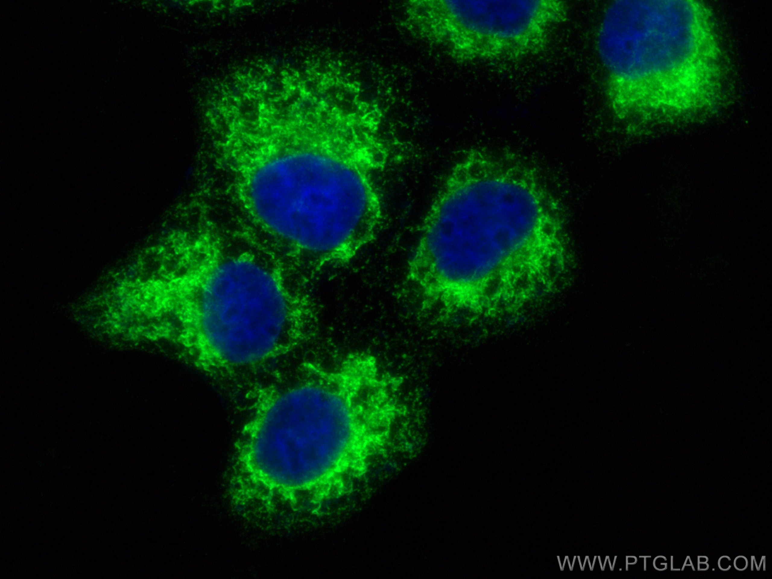 Immunofluorescence (IF) / fluorescent staining of A431 cells using ERp72 Polyclonal antibody (14712-1-AP)