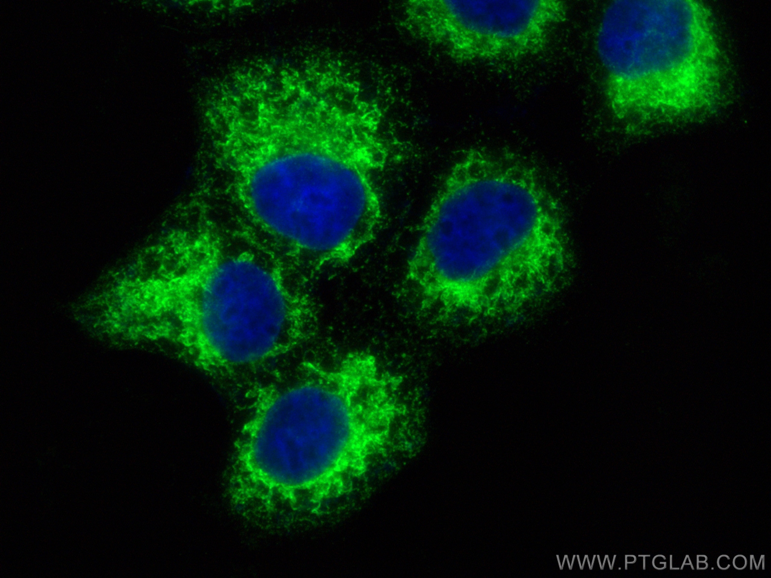 IF Staining of A431 using 14712-1-AP