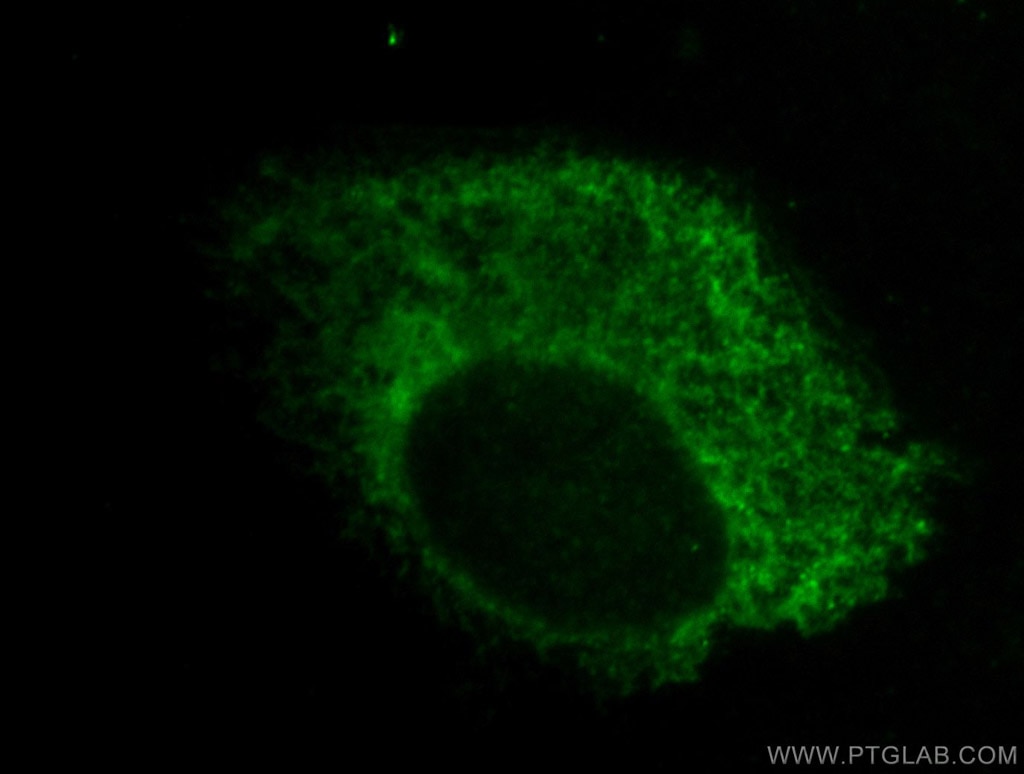 Immunofluorescence (IF) / fluorescent staining of PC-3 cells using ERp72 Polyclonal antibody (14712-1-AP)