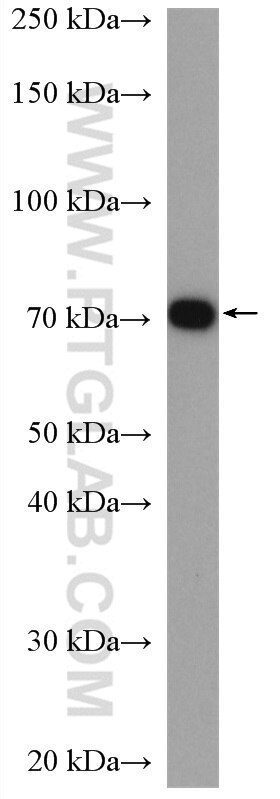 Western Blot (WB) analysis of mouse brain tissue using ERp72 Polyclonal antibody (14712-1-AP)