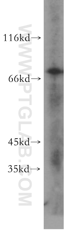 Western Blot (WB) analysis of L02 cells using ERp72 Polyclonal antibody (14712-1-AP)