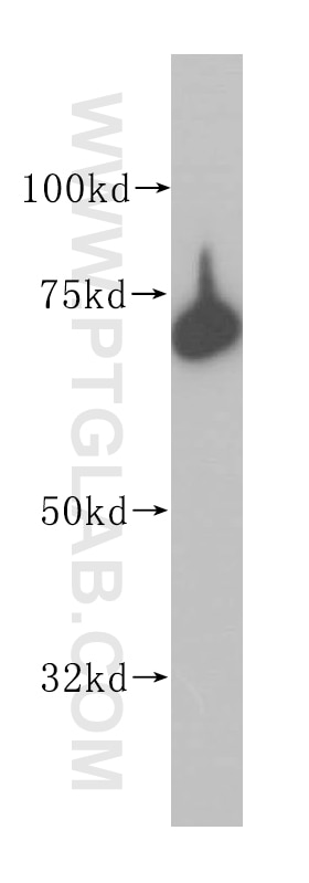 WB analysis of HeLa using 14712-1-AP