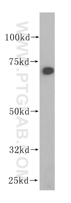 Western Blot (WB) analysis of HepG2 cells using ERp72 Polyclonal antibody (14712-1-AP)