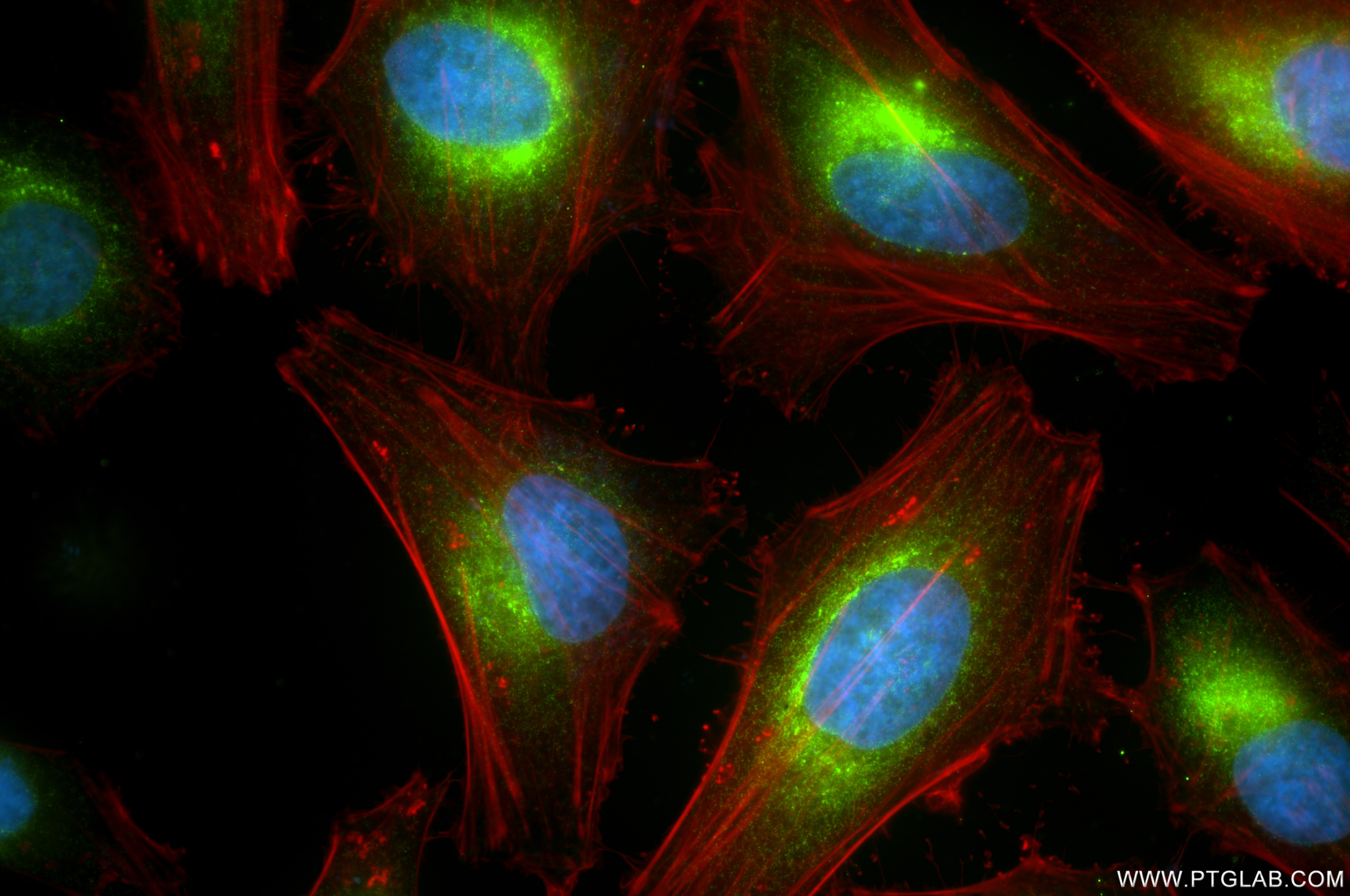 Immunofluorescence (IF) / fluorescent staining of HeLa cells using PDIA4 Recombinant antibody (86239-1-RR)