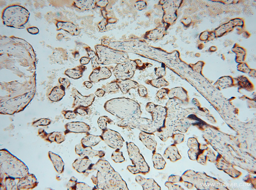 IHC staining of human placenta using 15545-1-AP